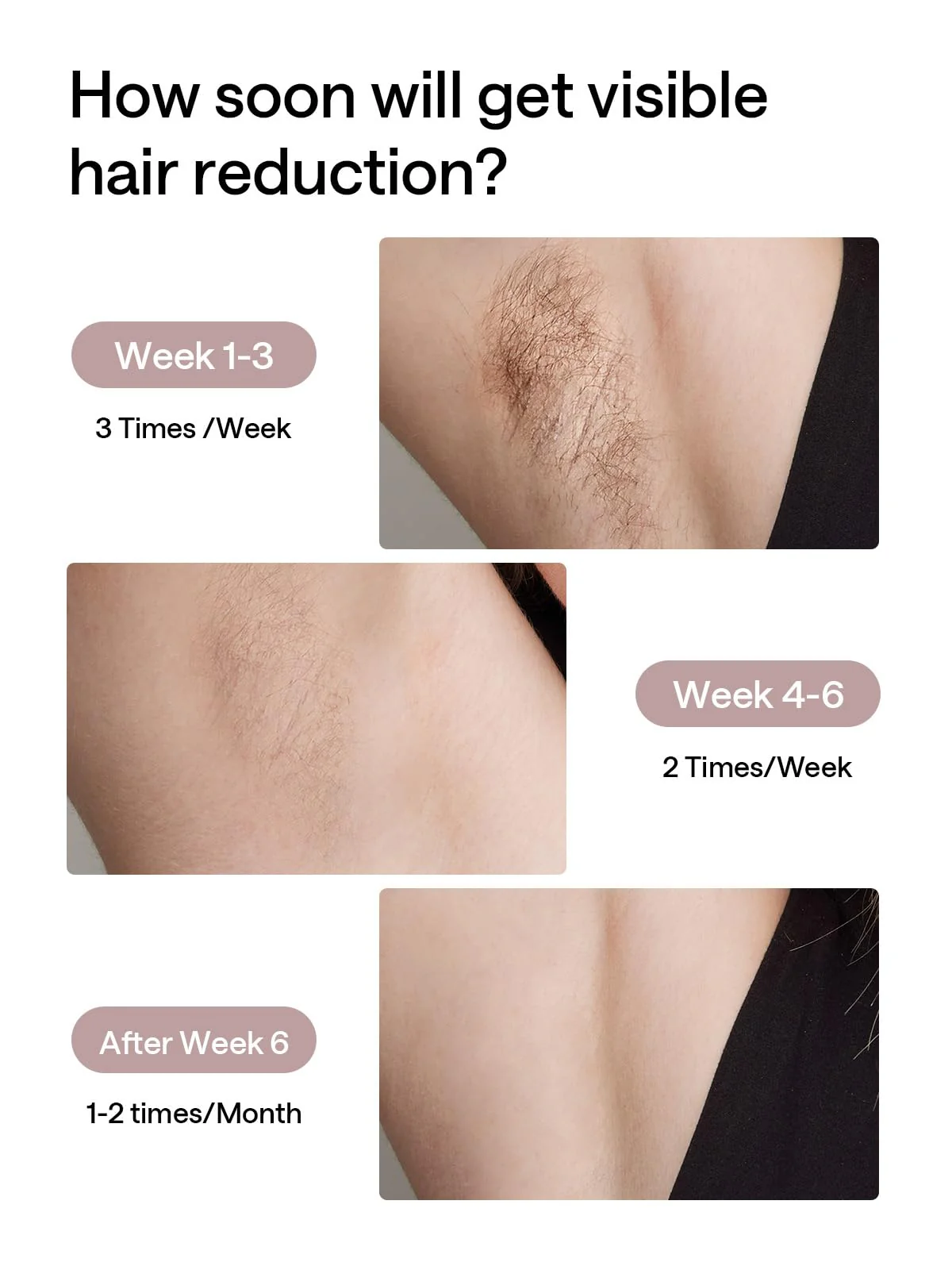 Ulike Laser Hair Removal for Women and Men
